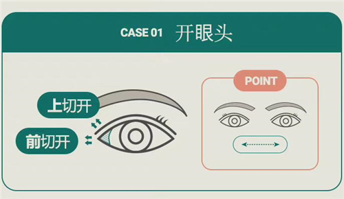 开内眼角示意图