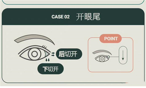 开外眼角示意图