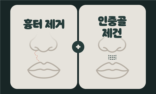 别人问我为什么找韩国WJ原辰做唇腭裂二期修复,因为技术啊