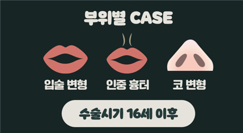 韩国WJ原辰整形外科唇腭裂2期手术内容