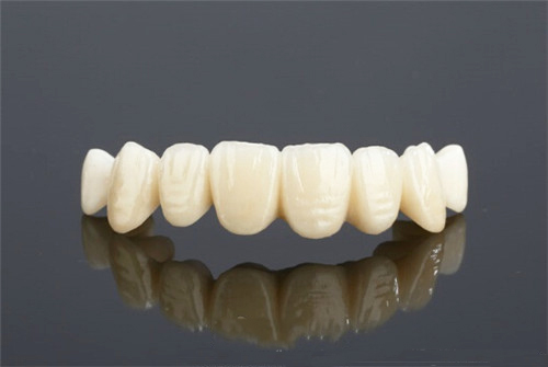 陶瓷牙齿多少钱一个图片
