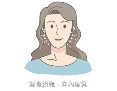 新疆黎美整形美容医院拉皮手术图