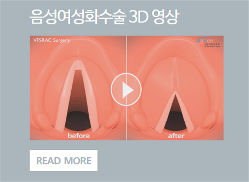 韩国艺颂嗓音中心医院声音整形动画