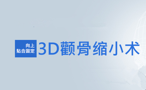 韩国德莱茵-3D颧骨缩小术