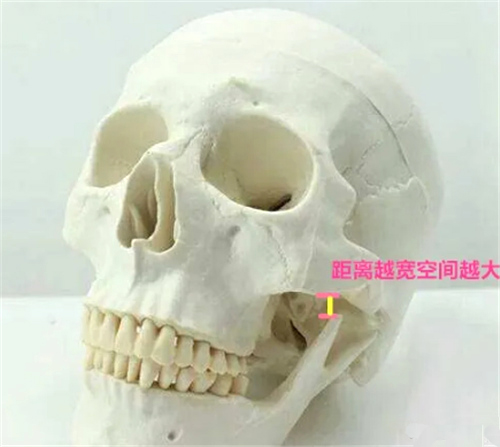 颅骨模型图
