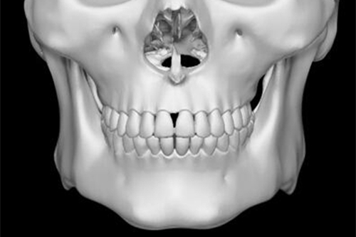 揭秘韩国H整形外科医院下颌角手术怎么做的 附图！
