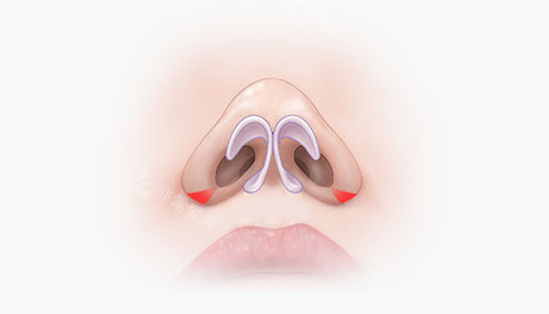 鼻孔角度和结构