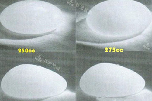 隆胸假体型号示意图