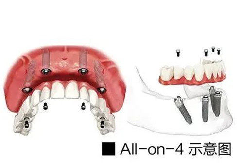 解答“鄂尔多斯口腔医院”的相关资料！看牙技术真的不错