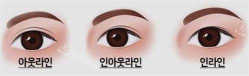 雙眼皮示意圖 雙眼皮示意圖