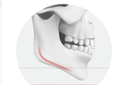 下巴示意图