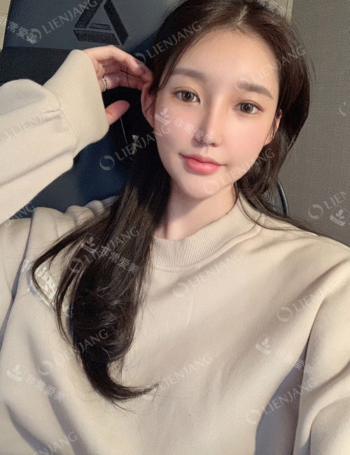 是韓國麗延長整形眼部修復(fù)好嗎