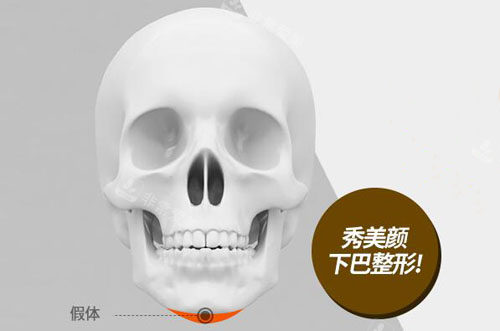 韓國秀美顏整形下巴硅膠假體部位 韓國秀美顏整形下巴硅膠假體部位