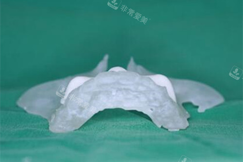 韩国H整形外科医院3D打印技术