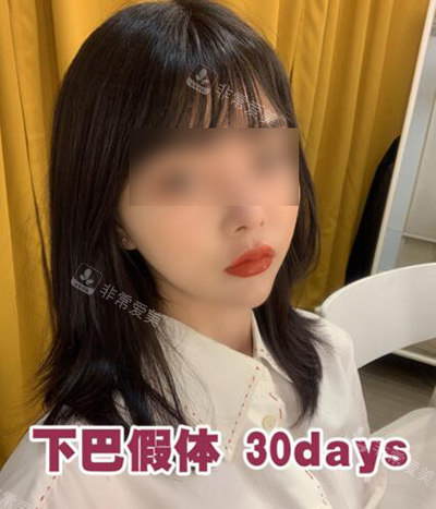 韓國(guó)UcanB整形外科一個(gè)月展示 韓國(guó)UcanB整形外科一個(gè)月展示