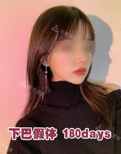 韓國(guó)UcanB整形外科半年展示 韓國(guó)UcanB整形外科半年展示