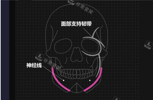 面部支持韌帶、下巴神經(jīng)線分布圖 面部支持韌帶、下巴神經(jīng)線分布圖