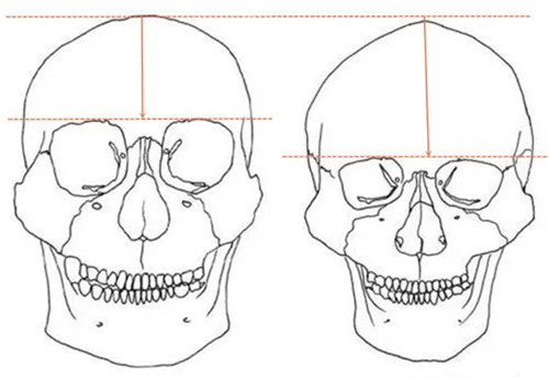 頭部以及面部輪廓改善前后