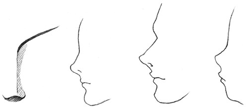 各类鼻子形态