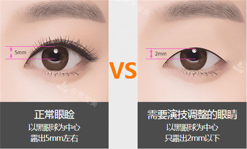 眼部美觀數(shù)據(jù)表現(xiàn)圖 眼部美觀數(shù)據(jù)表現(xiàn)圖