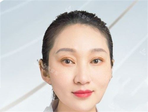 成都圣母醫(yī)院整形科張麗醫(yī)生 成都圣母醫(yī)院整形科張麗醫(yī)生
