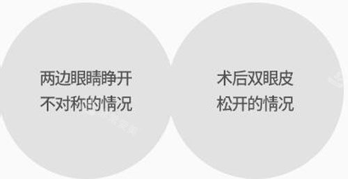 韓國(guó)秀美顏整形外科雙眼皮修復(fù)手術(shù)方式分析