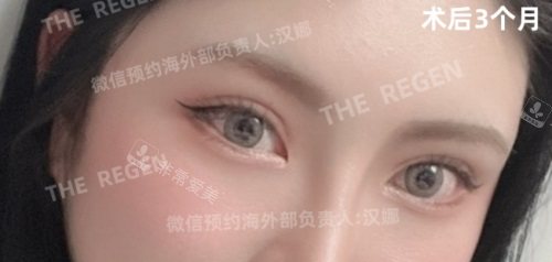 術(shù)后3個(gè)月 術(shù)后3個(gè)月