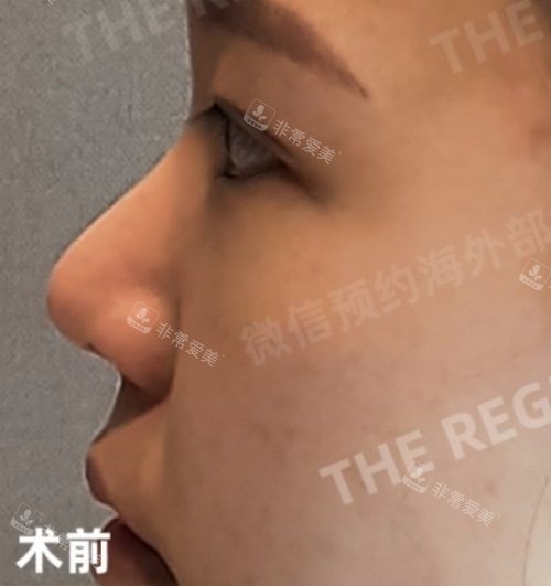 術(shù)前 術(shù)前