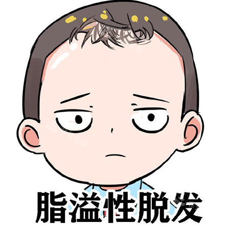脂溢性脫發(fā)卡通圖展示 脂溢性脫發(fā)卡通圖展示
