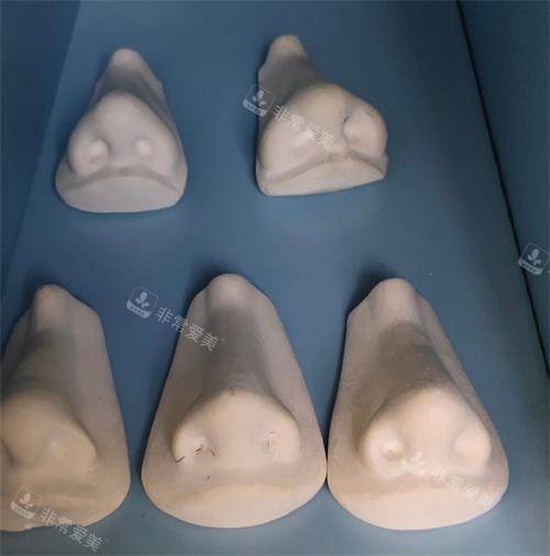 南京鼻祖整形鼻部整形模型示意图