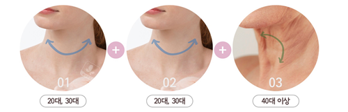 颈纹可以消除吗?分享韩国专门去颈纹医院延世多仁真人实例