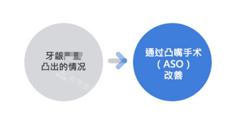 牙齦突出需要做凸嘴手術(shù)