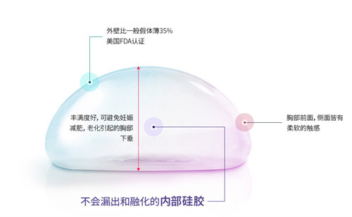 胸部假體示意圖 胸部假體示意圖