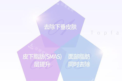 韓國(guó)秀美顏整形外科除皺方式介紹 韓國(guó)秀美顏整形外科除皺方式介紹