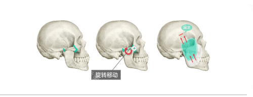 韩国贝缇莱茵整形提升3维颧骨旋转术好厉害,对比照看看