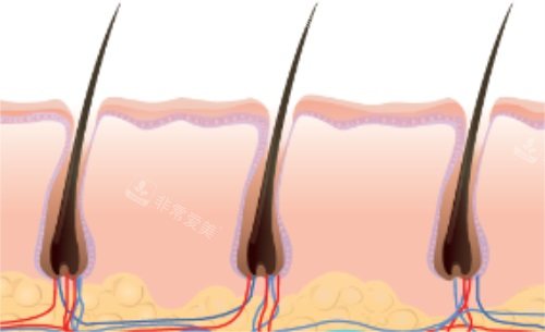 毛囊示意图