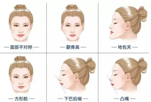 各類頜面畸形展示圖 各類頜面畸形展示圖