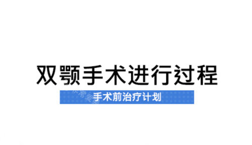 韩国德莱茵整形双颚手术术前计划