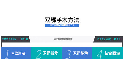 雙顎整形手術(shù)步驟 雙顎整形手術(shù)步驟