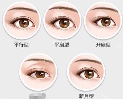 各种类型的双眼皮 各种类型的双眼皮