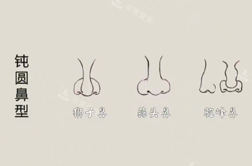 鈍圓鼻型示意圖 鈍圓鼻型示意圖