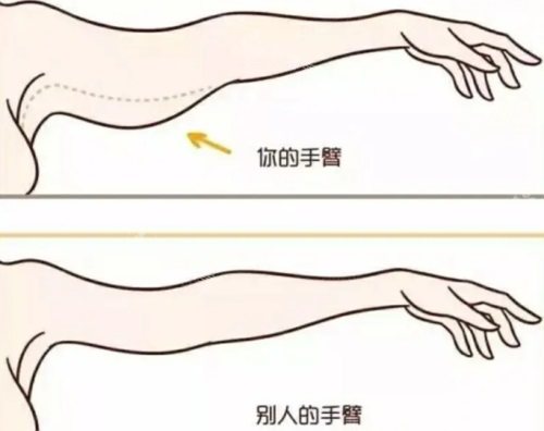 韩国手臂吸脂好的医院：宝士丽整形是整友评价比较高的！