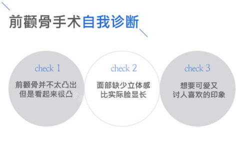 什么樣的人適合前顴骨整形 什么樣的人適合前顴骨整形