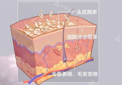 毛囊检测问题示意图