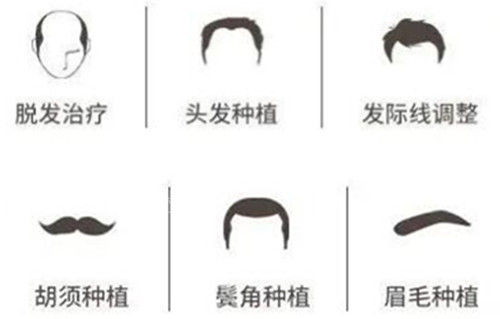 新生植發(fā)開展項(xiàng)目類型圖