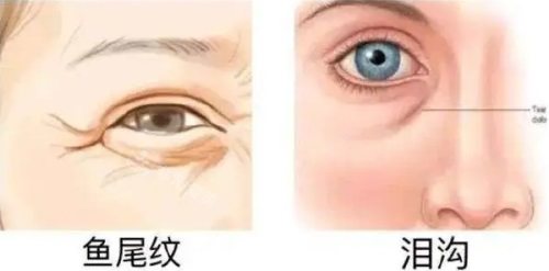 眼周問題示意圖 眼周問題示意圖