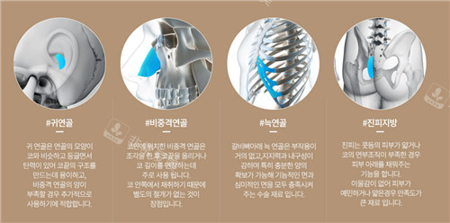 韩国noselip整形外科鼻整形自体材料展示图