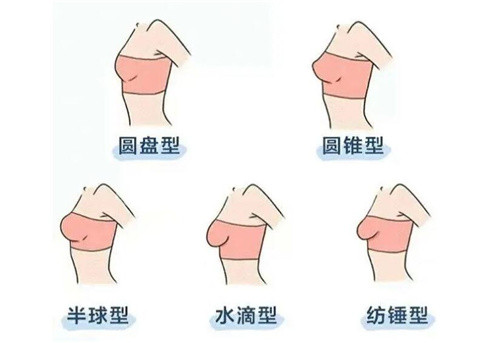 不同胸型示意圖 不同胸型示意圖