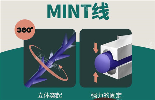 八字纹埋线提升线材示意图