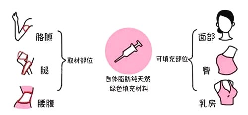 自體脂肪用途示意圖 自體脂肪用途示意圖